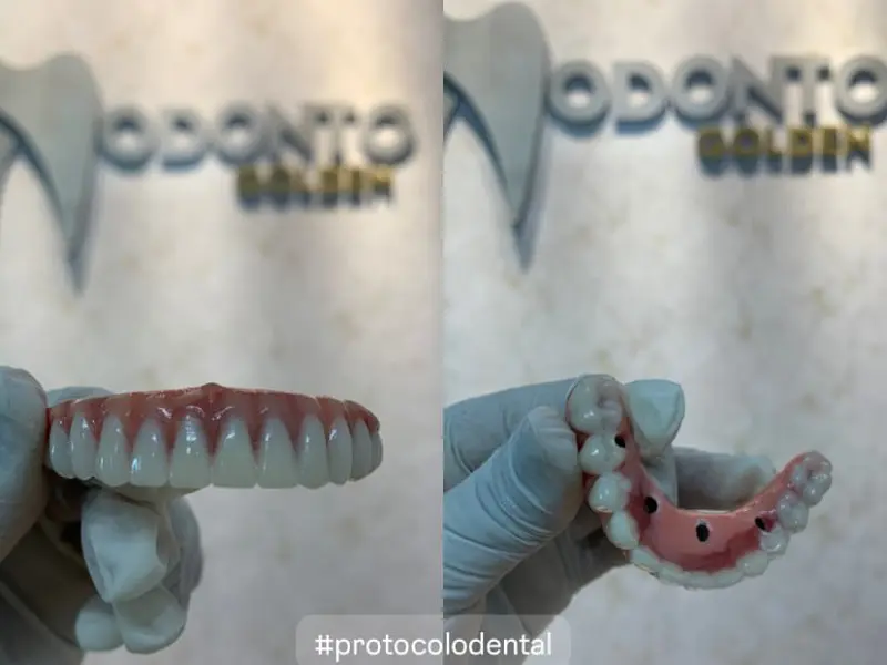 Prótese protocolo exibida na Odonto Golden